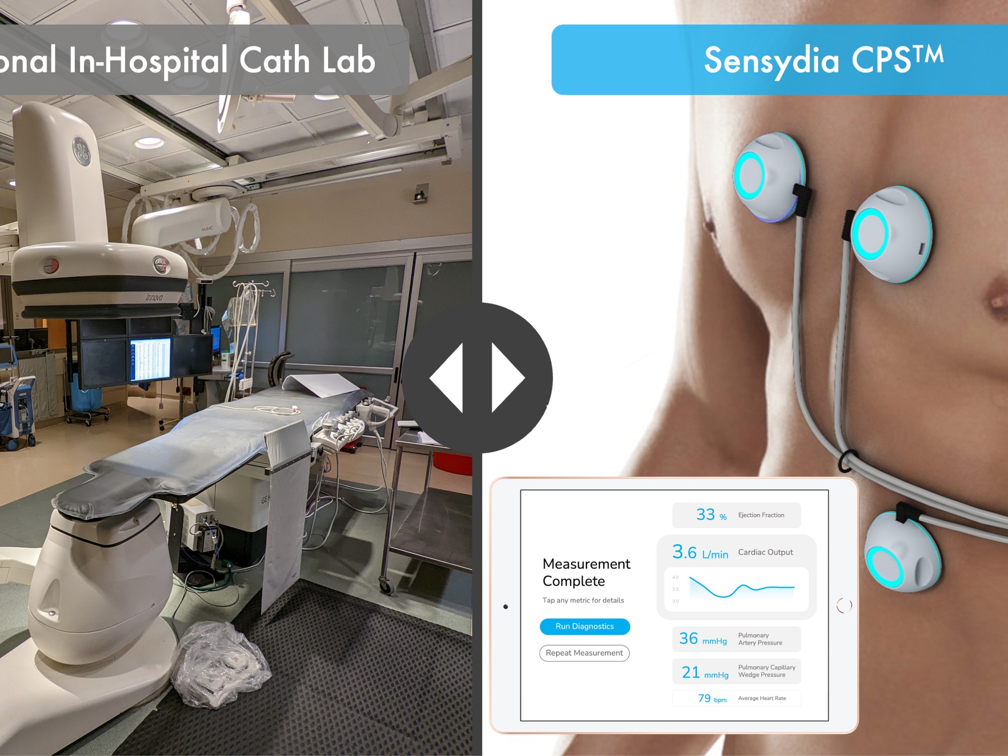 Sensydia Raises $8 Million To Revolutionize Heart Disease Screening