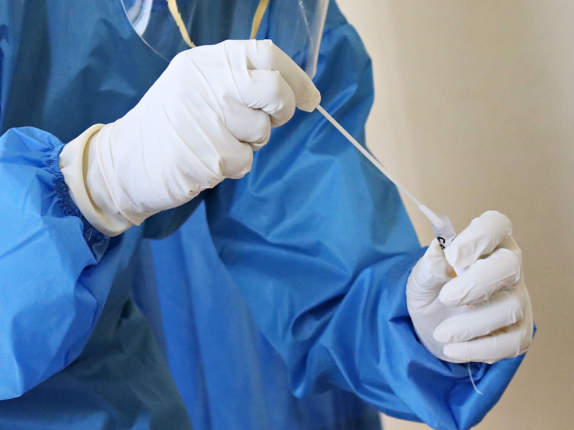 LA County Drops Curative COVID Test After FDA Alert on Accuracy