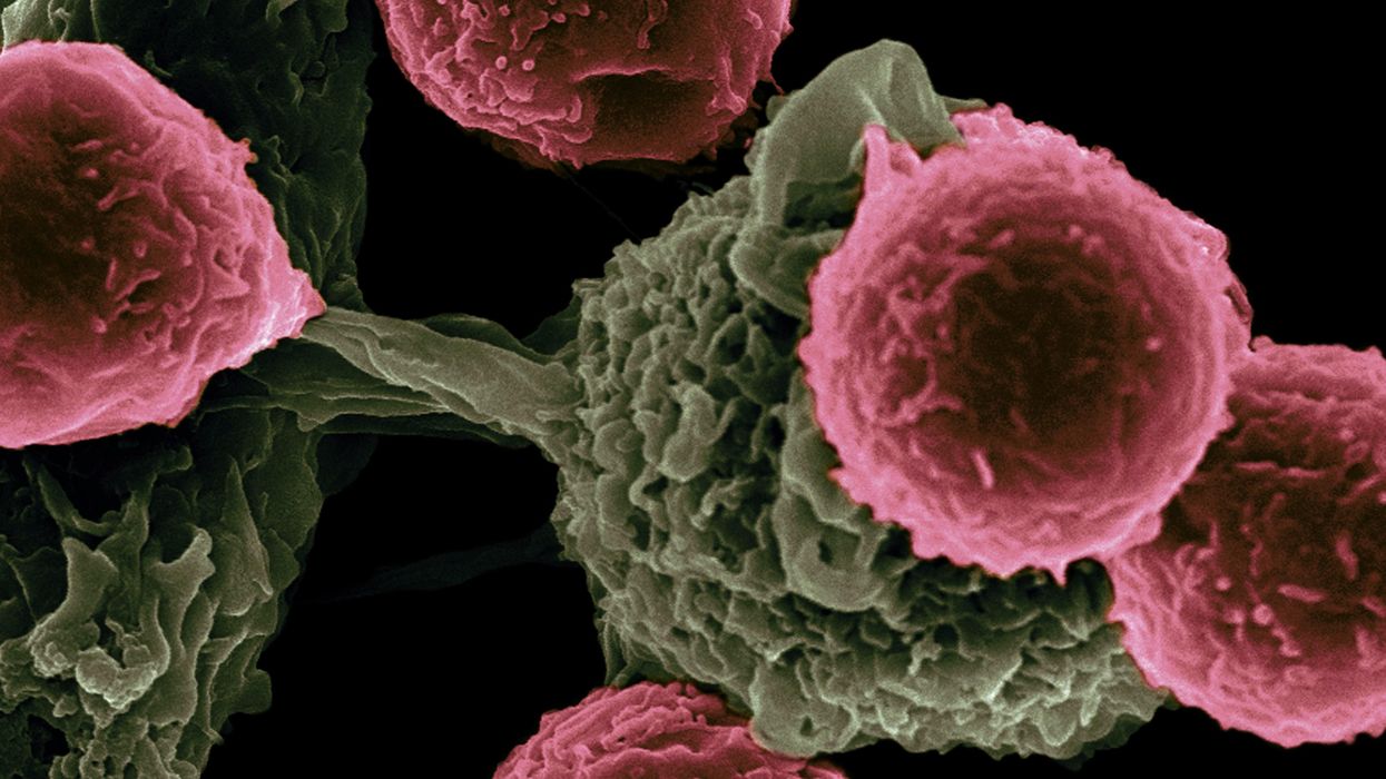 Immix Biopharma Receives Tepid Wall Street Reception in IPO Debut