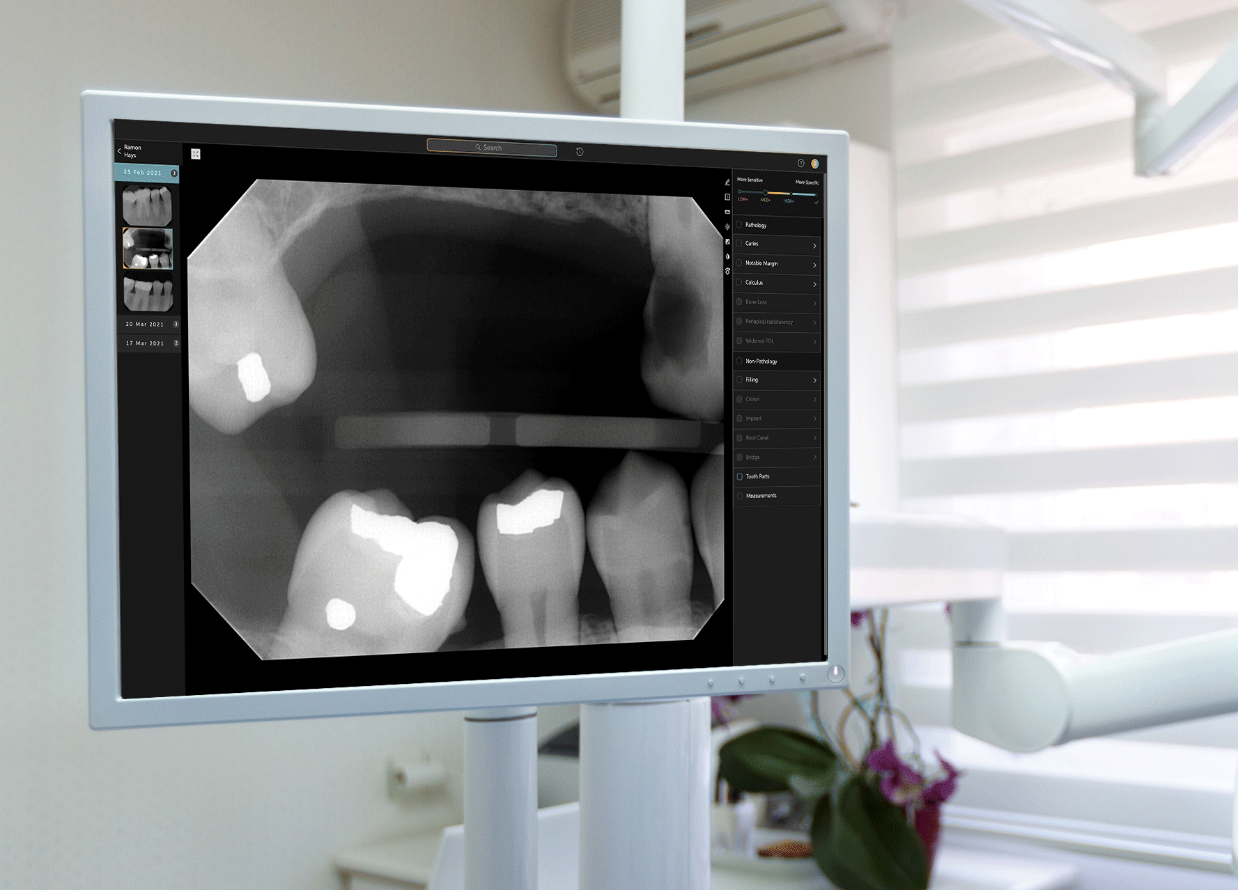 Pearl\u2019s AI program examine teeth.